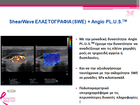 ULTRASOUND SHEARWAVE ELASTOGRAPHY