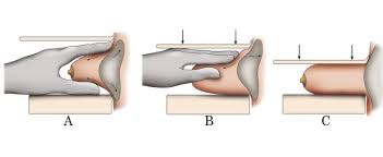 Magnetic Mammography